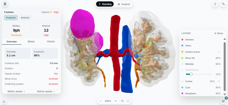 La startup che trasforma gli organi in modelli 3D